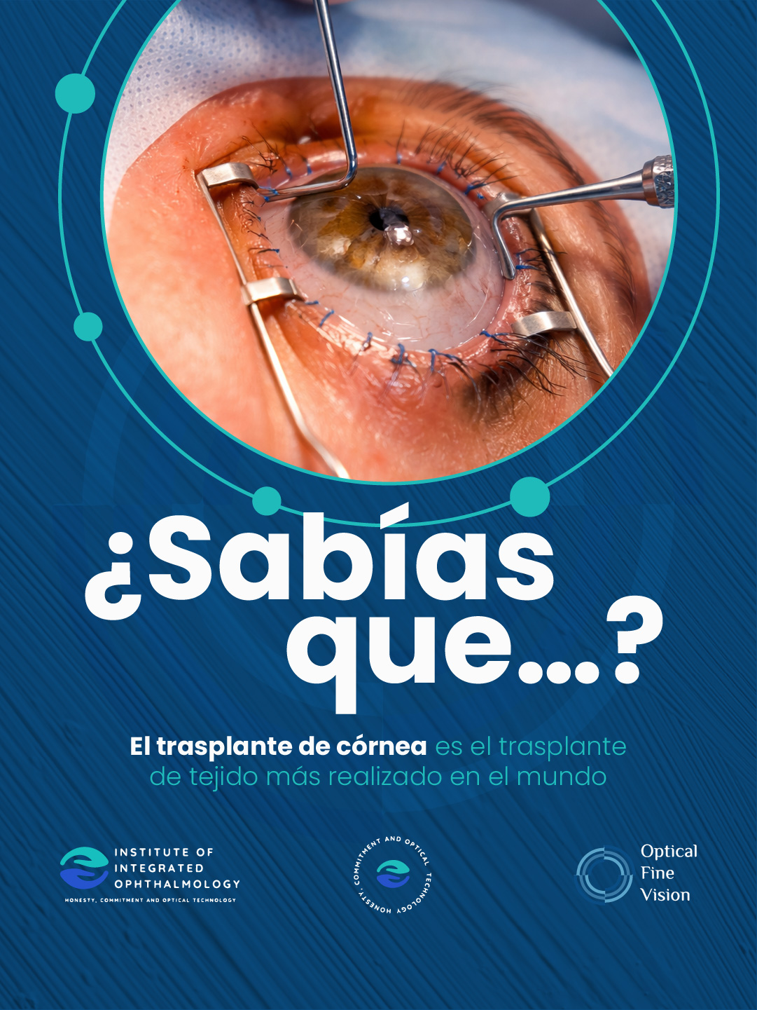 El trasplante de córnea es el trasplante de tejido más realizado en el mundo