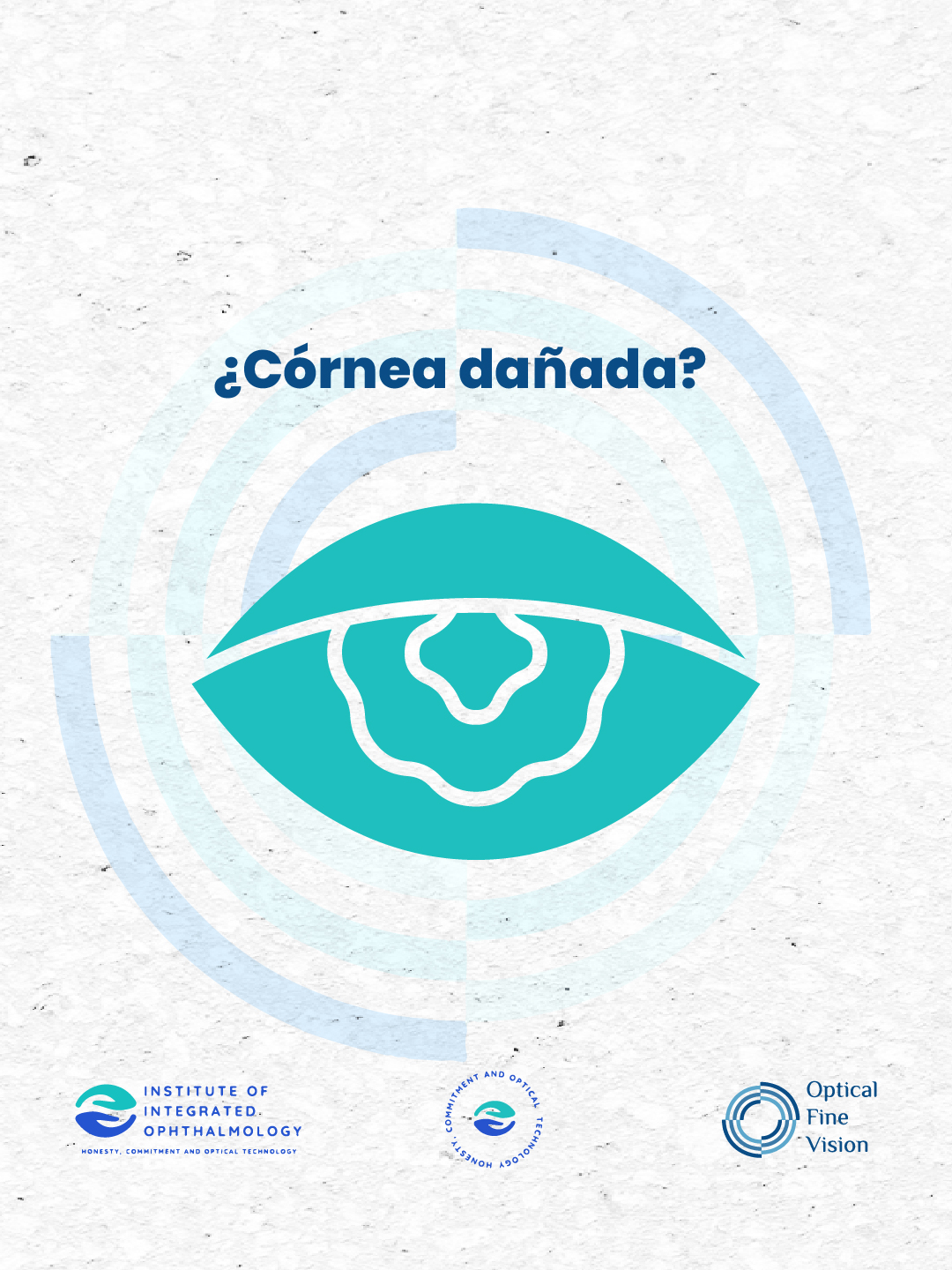 Ilustración de una córnea dañada