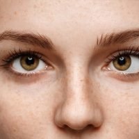 Exploración de alineación ocular en consulta